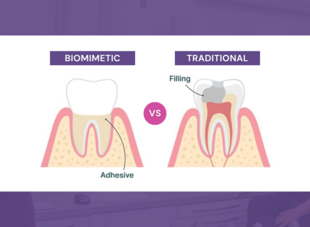 Biomimetic Dentistry vs Traditional Fillings and Crowns: Which Is Better for Your Tooth?