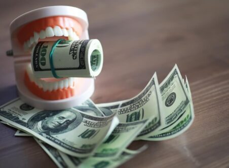 Accessible Dental Implant Finance with No Upfront Cost